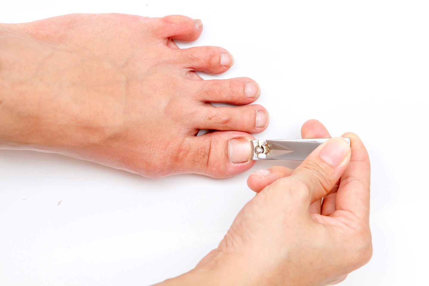 What Are The Most Common Causes Of Ingrown Toenails Podiatry Associates