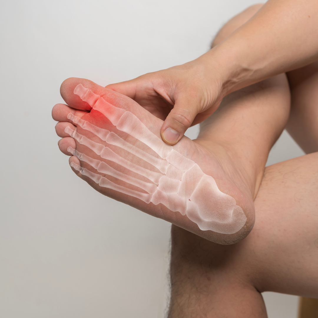 Podiatry Blog Arthritis in Your Feet Managing Big Toe Stiffness, Bunions & Joint Pain